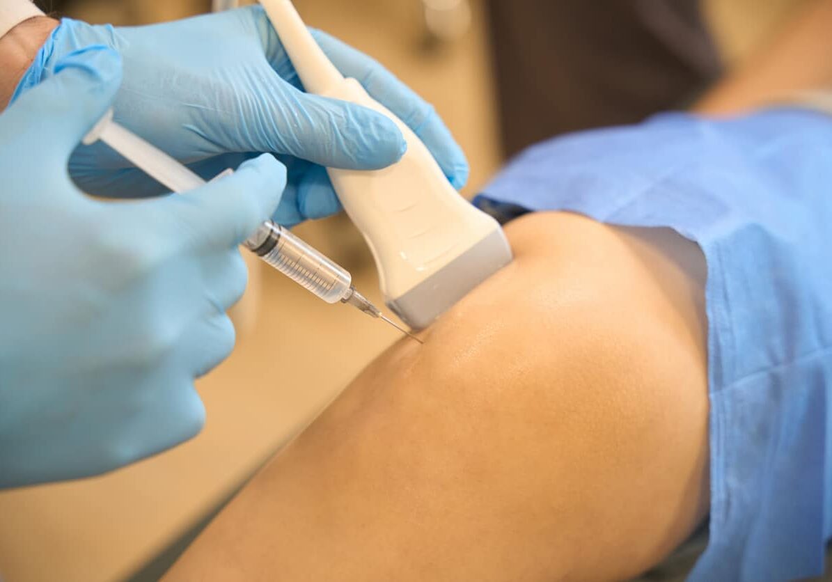 prp shoulder injection